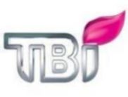 ТВі піде по міжнародних судах, якщо його позбавлять прав